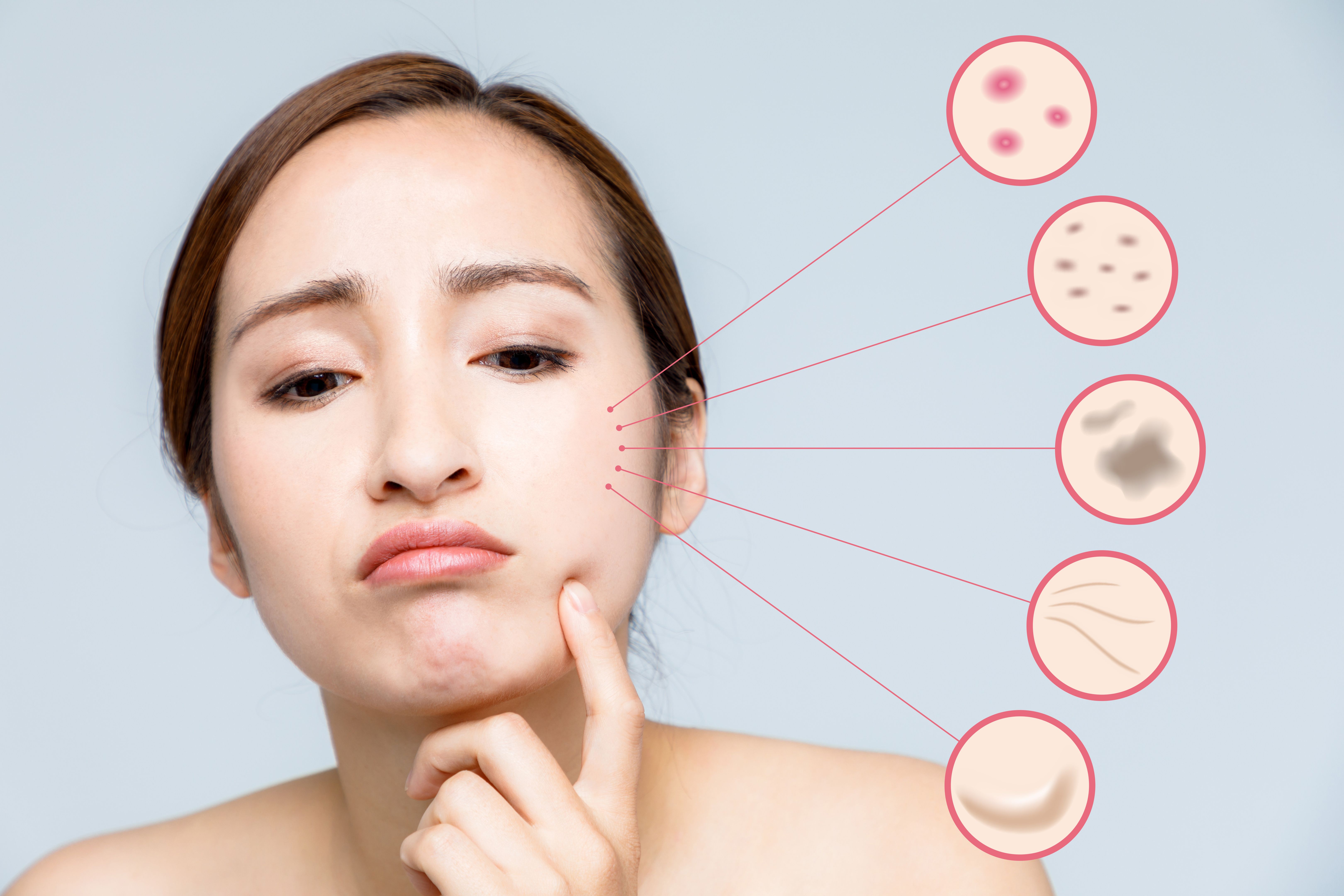 woman skin trouble. pimple, freckle, spot, wrinkle, saggy.