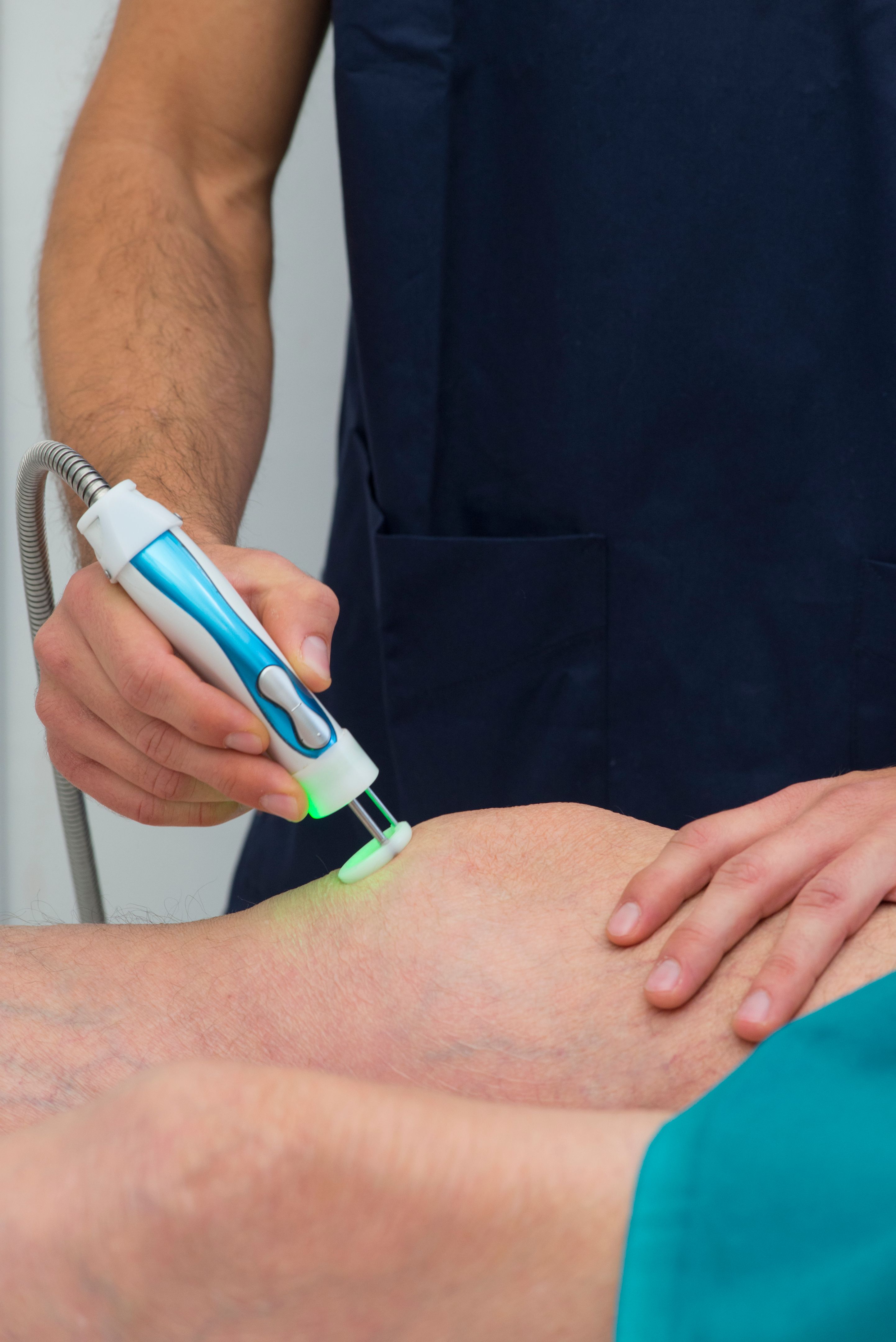 laser treatment varizes