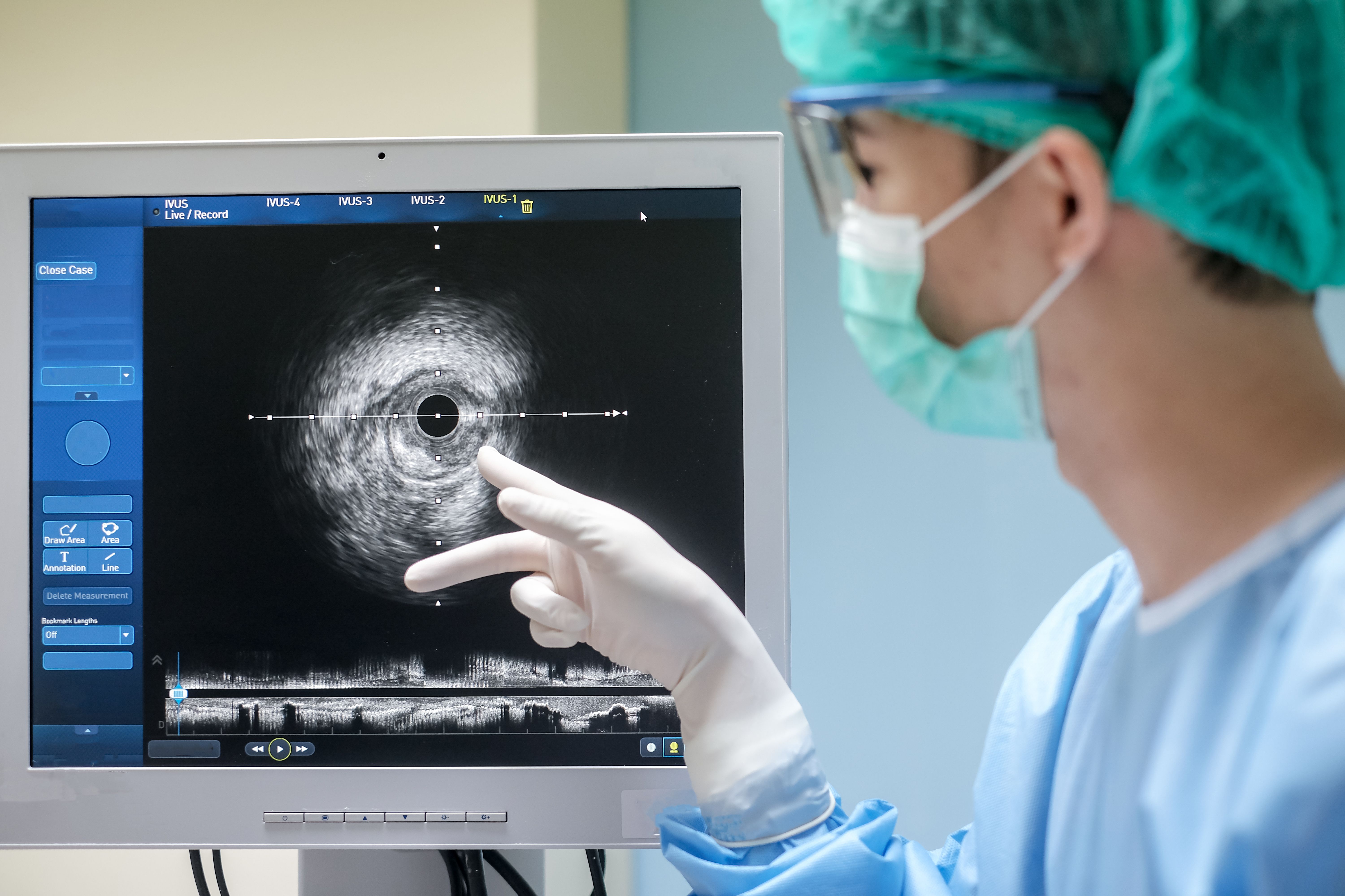 ultrasound technology