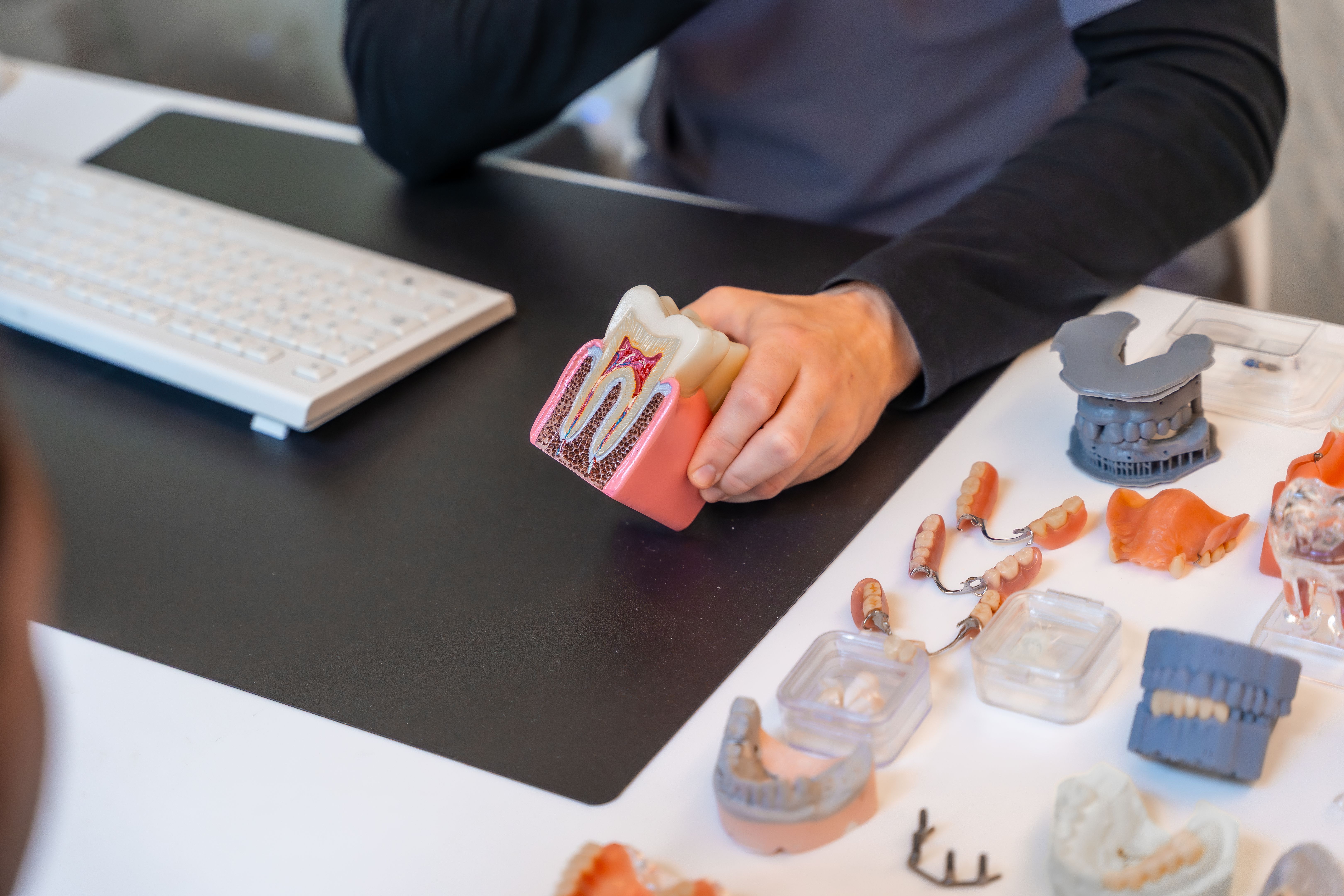 3d printed dental model