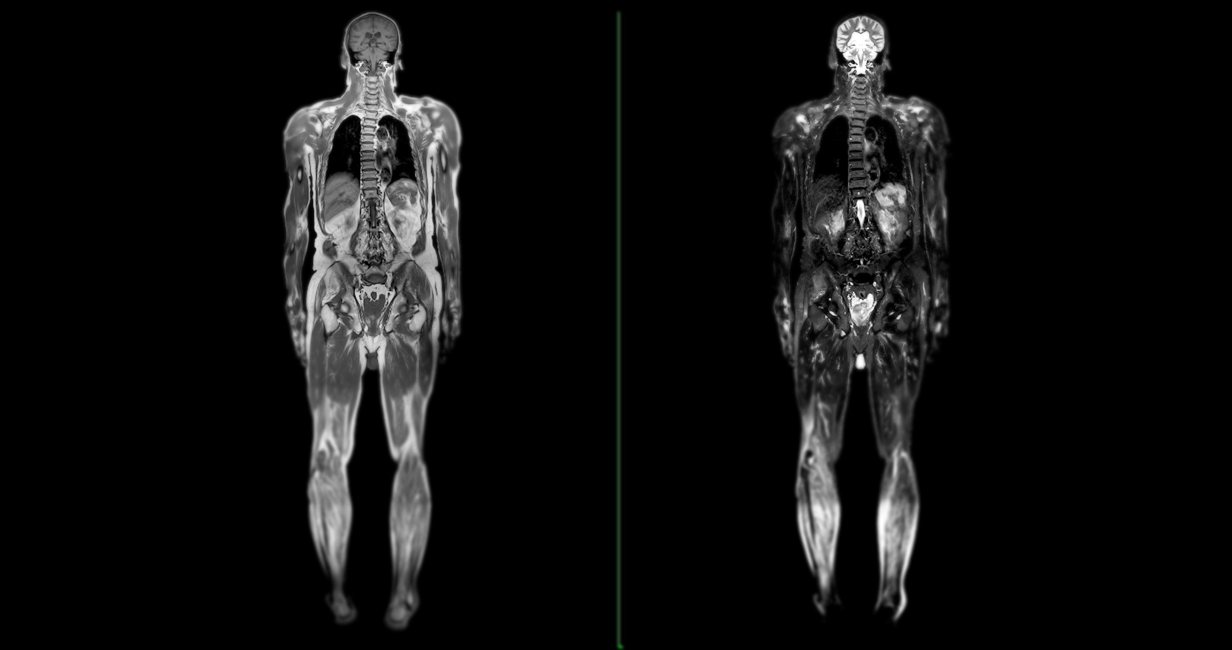 medical imaging