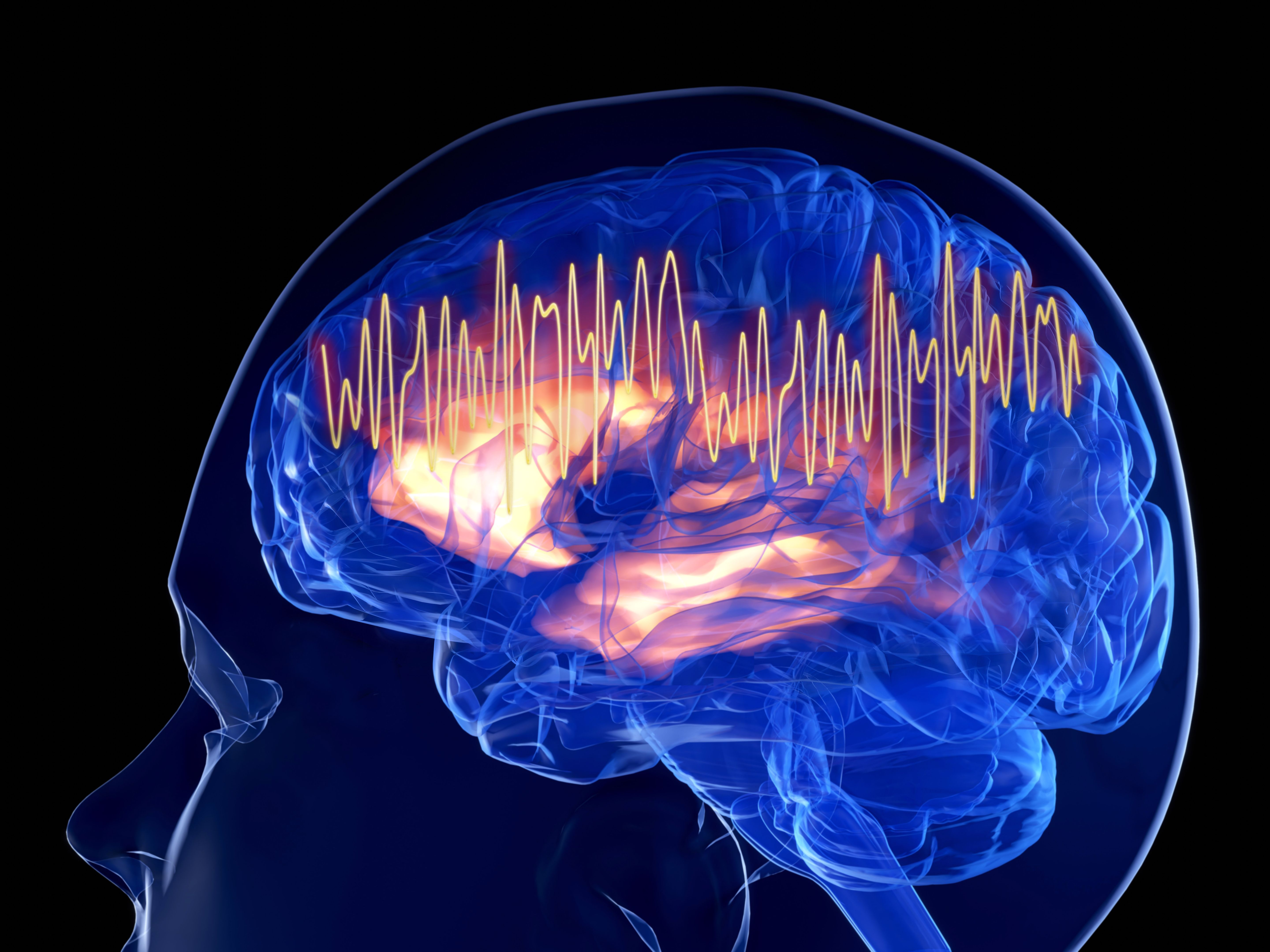 Gamma waves in the brain. Patient's of Alzheimer's disease show lagged gamma responses. Gamma waves in the brain. Patient's of Alzheimer's disease show lagged gamma responses.
