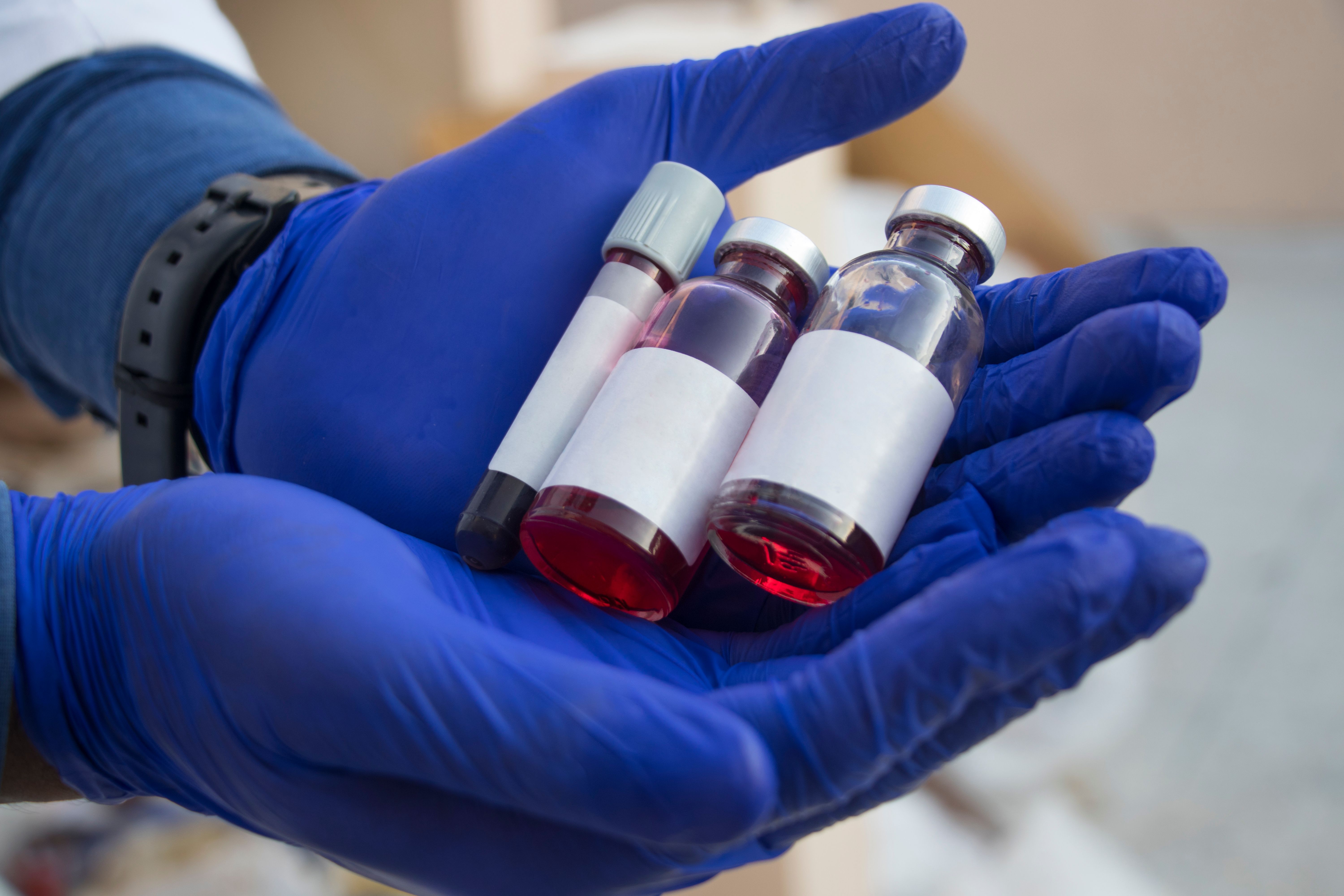 Close-up of a Hand Holding a Test Tube Filled with Blood