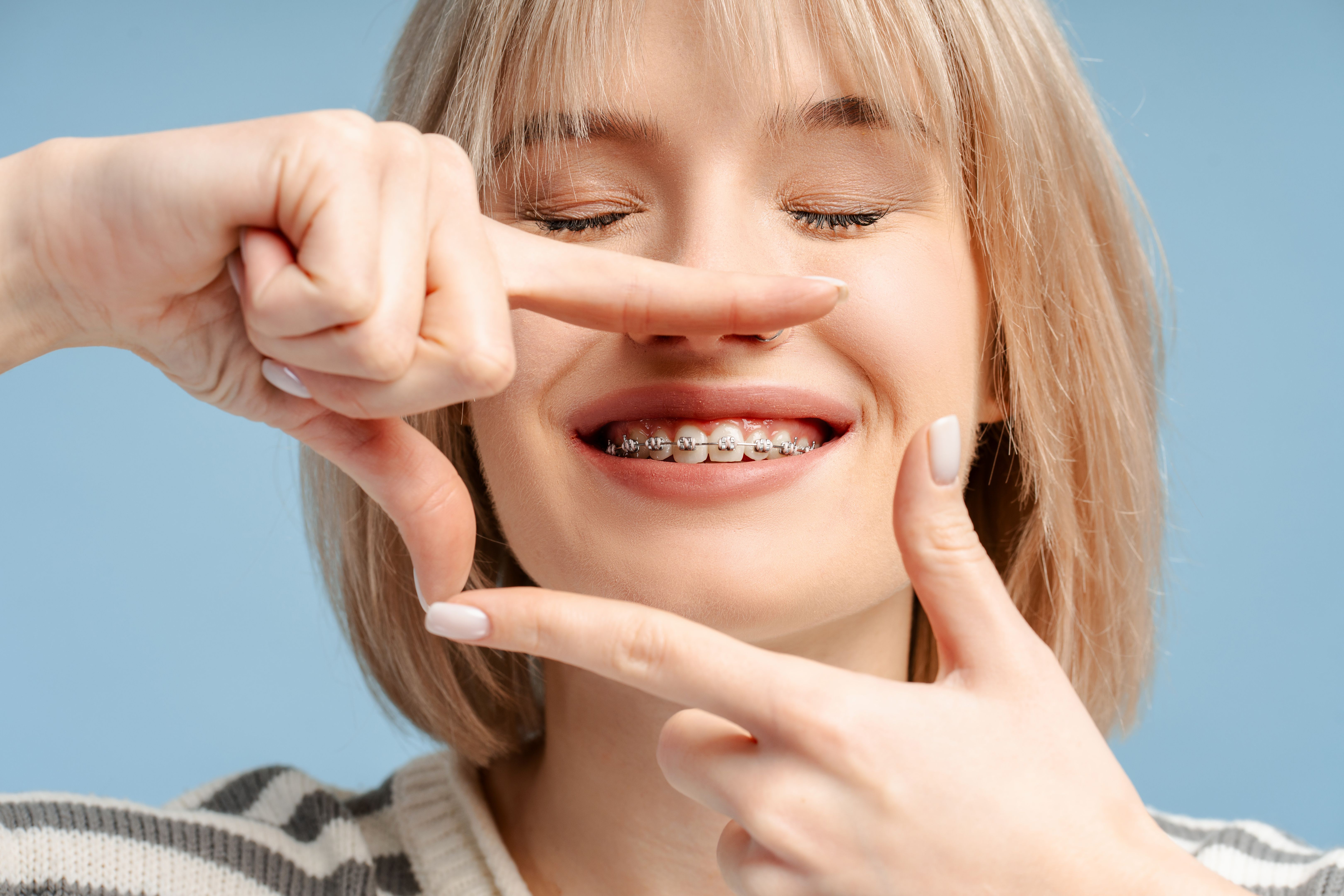 adult braces benefit