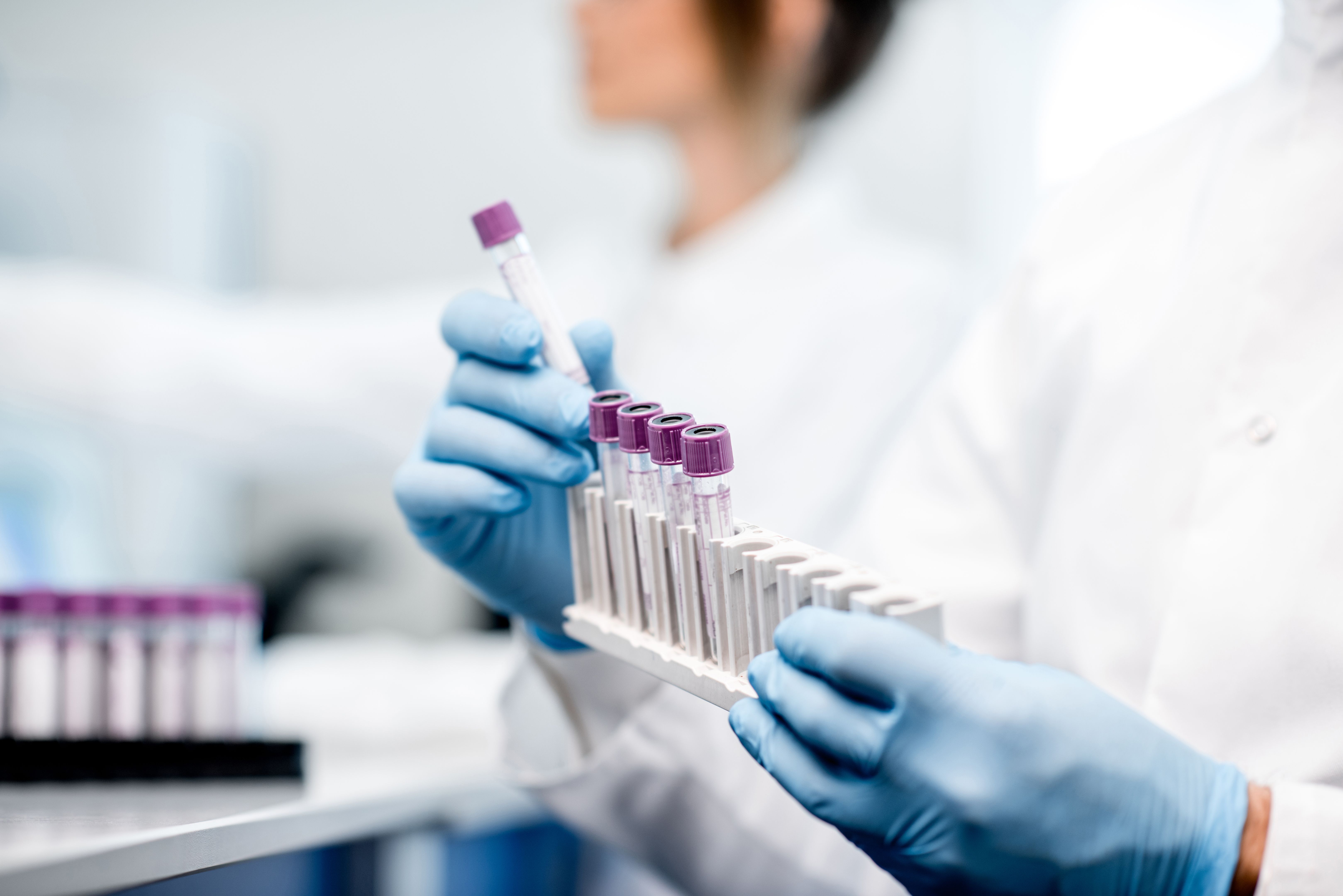 medical samples
