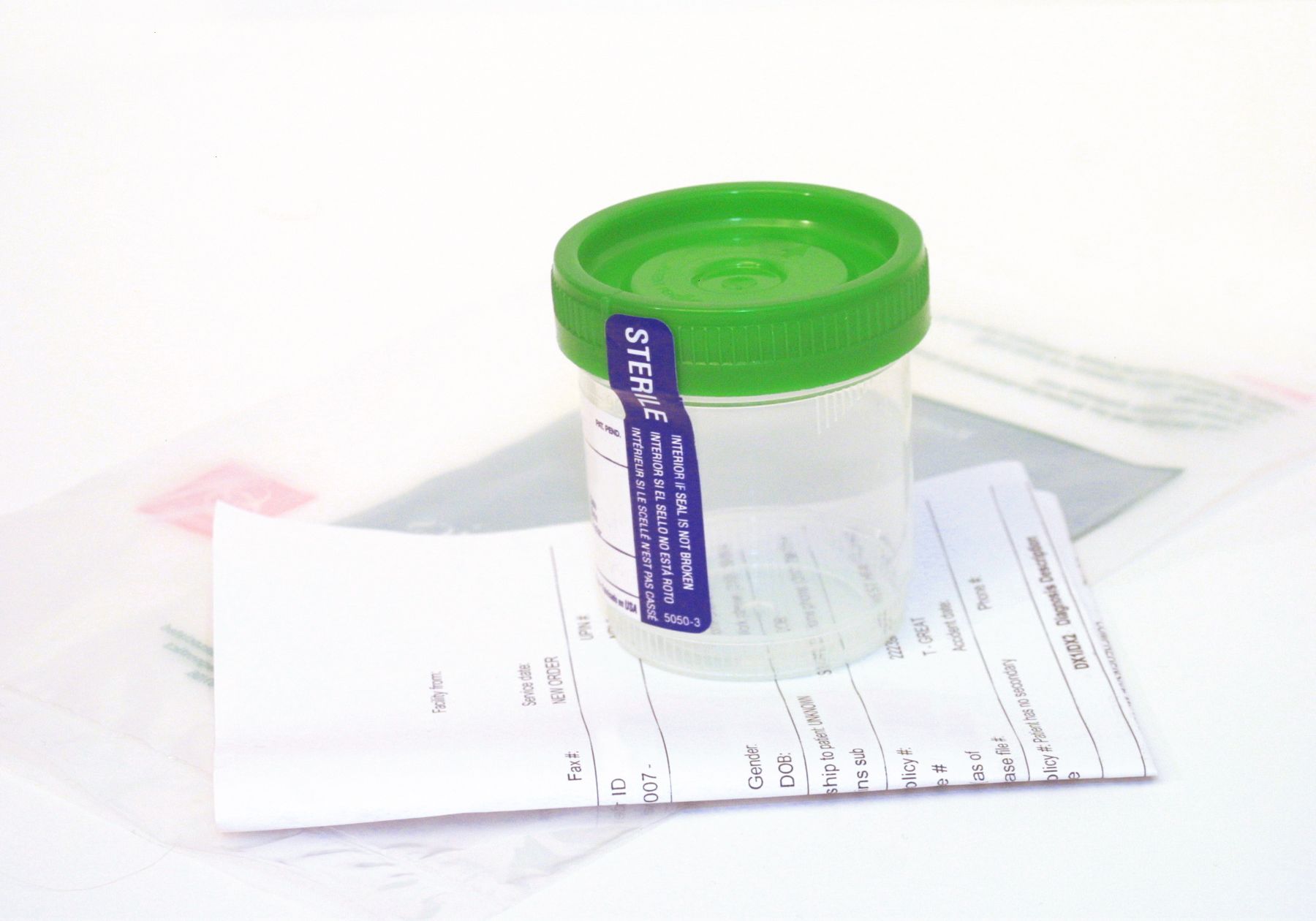Urine Lab Test Set