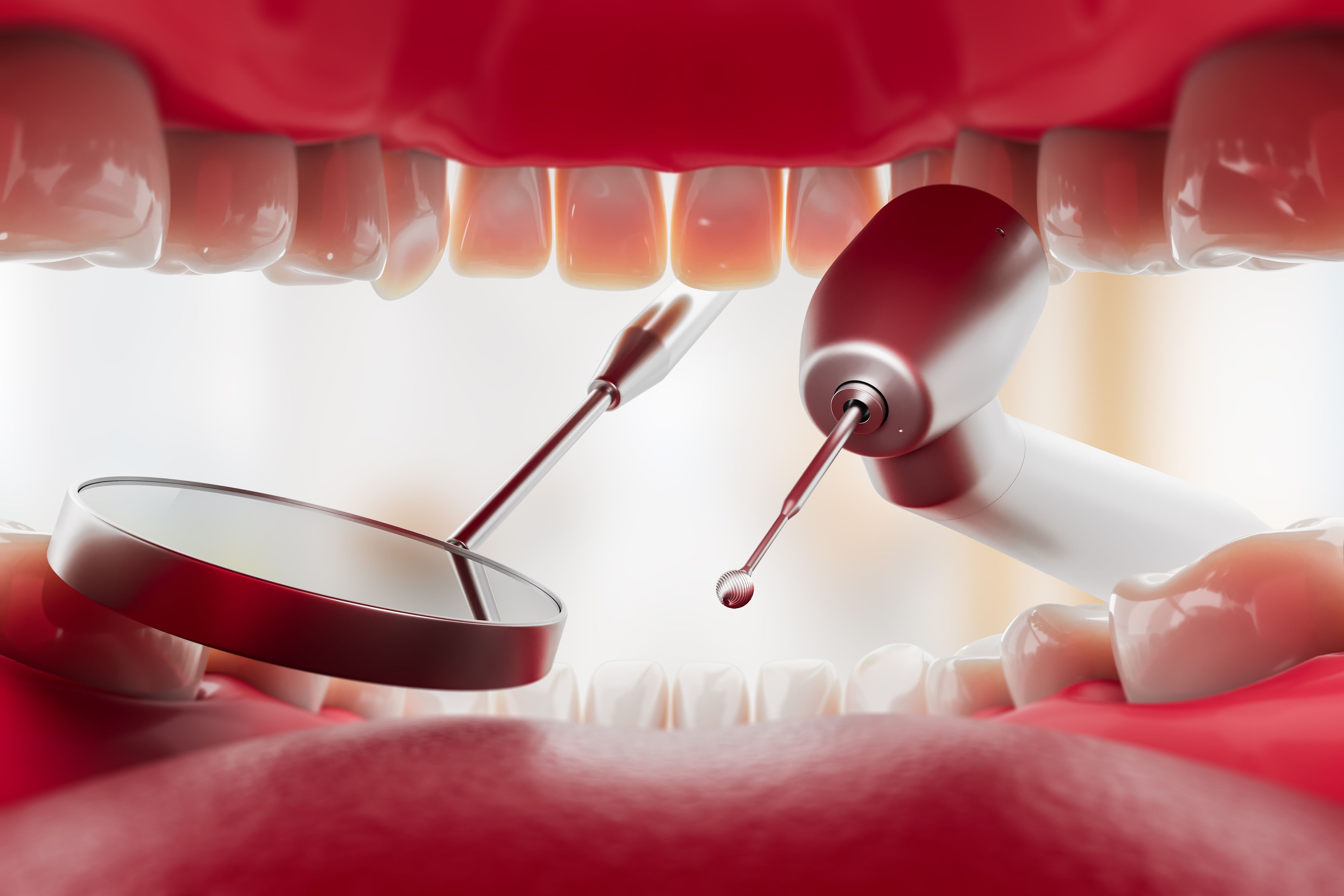 dental procedure illustration