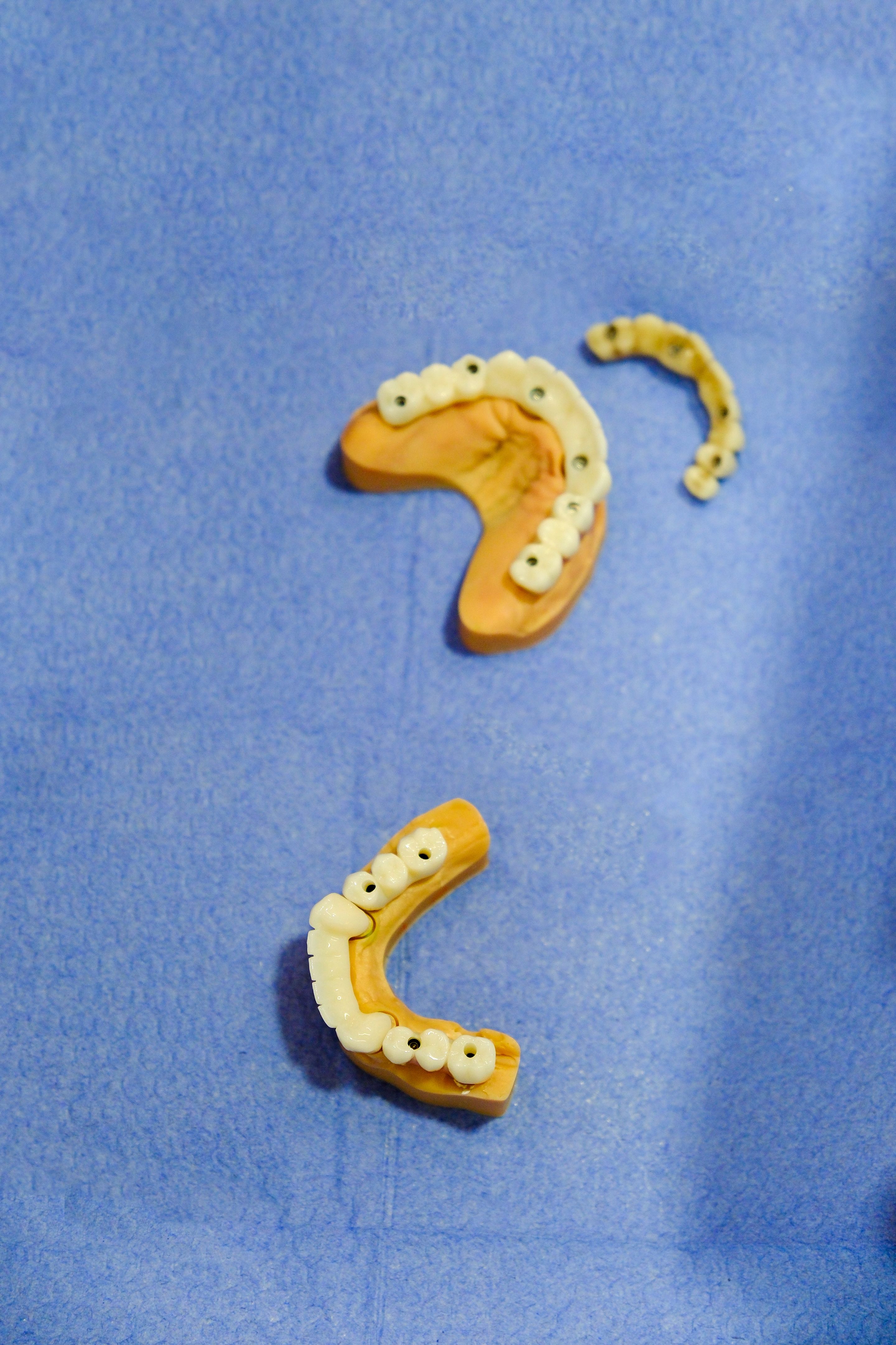 mini dental implants