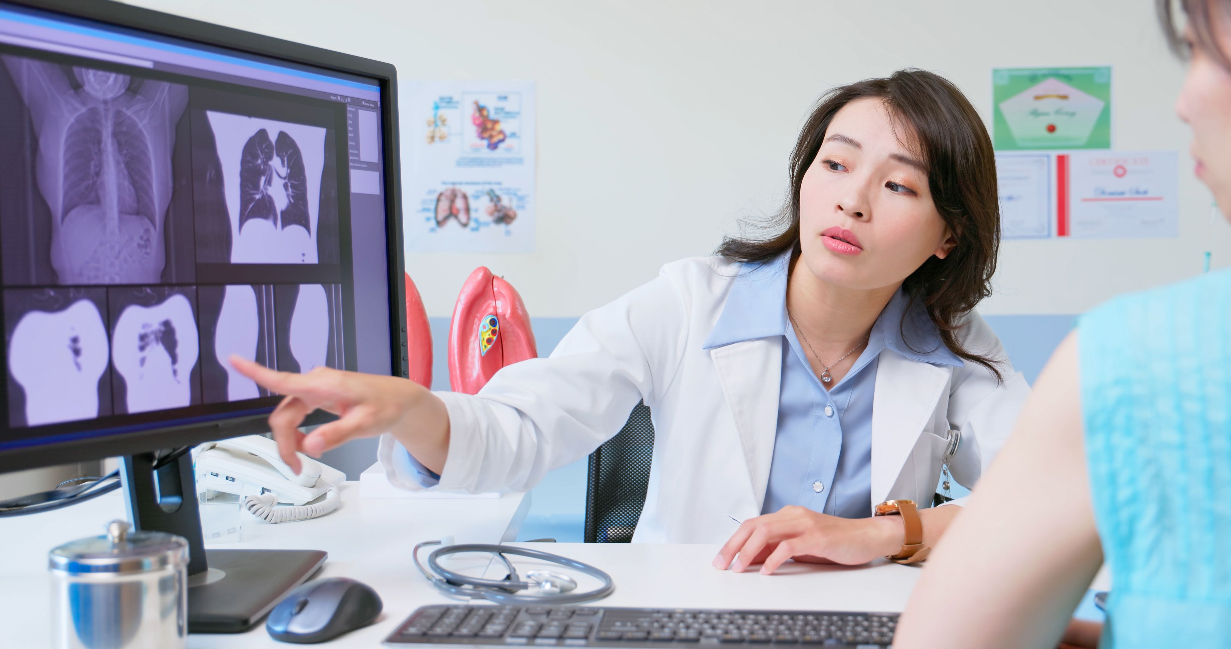 medical consultation lung CT scan