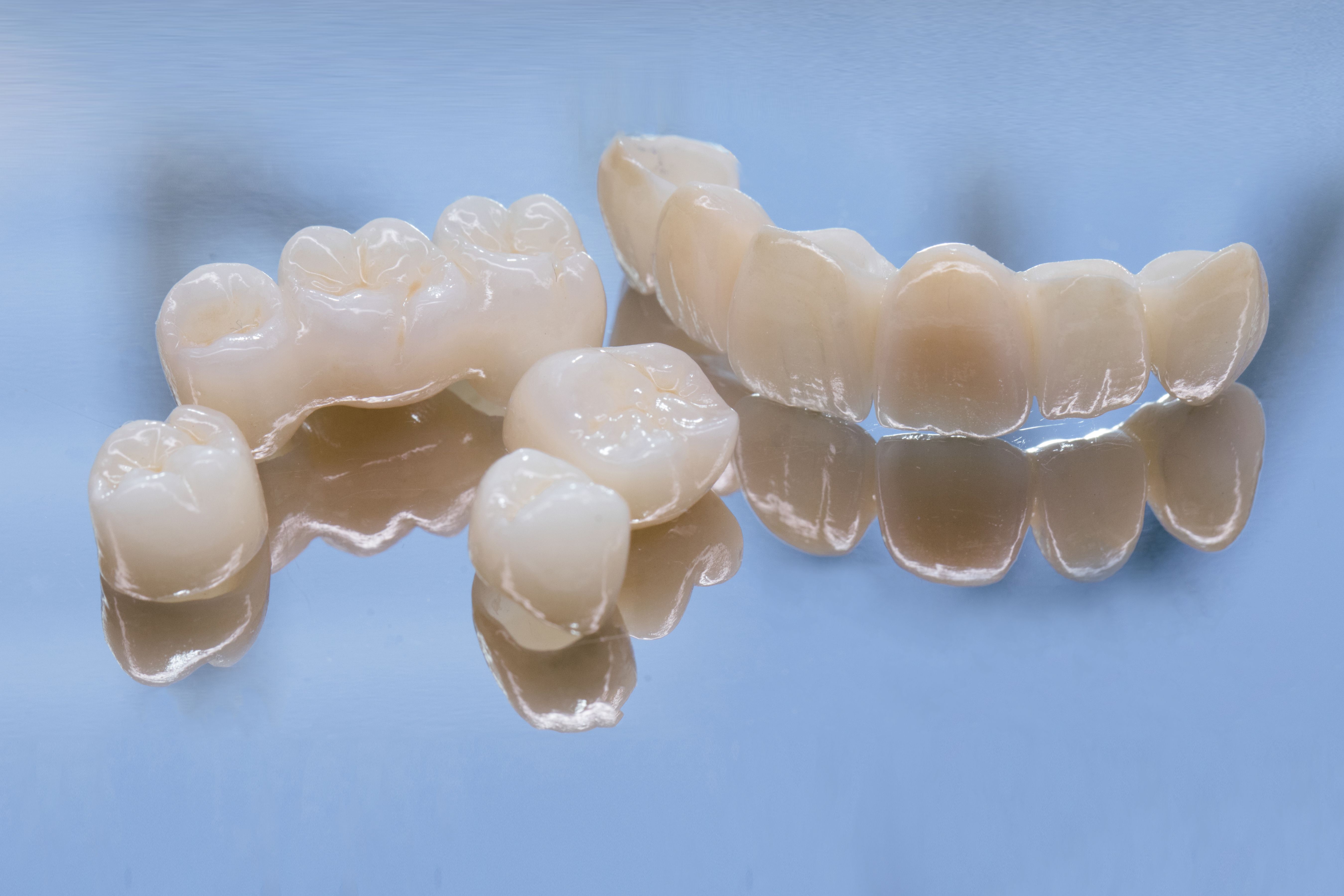 dental restoration