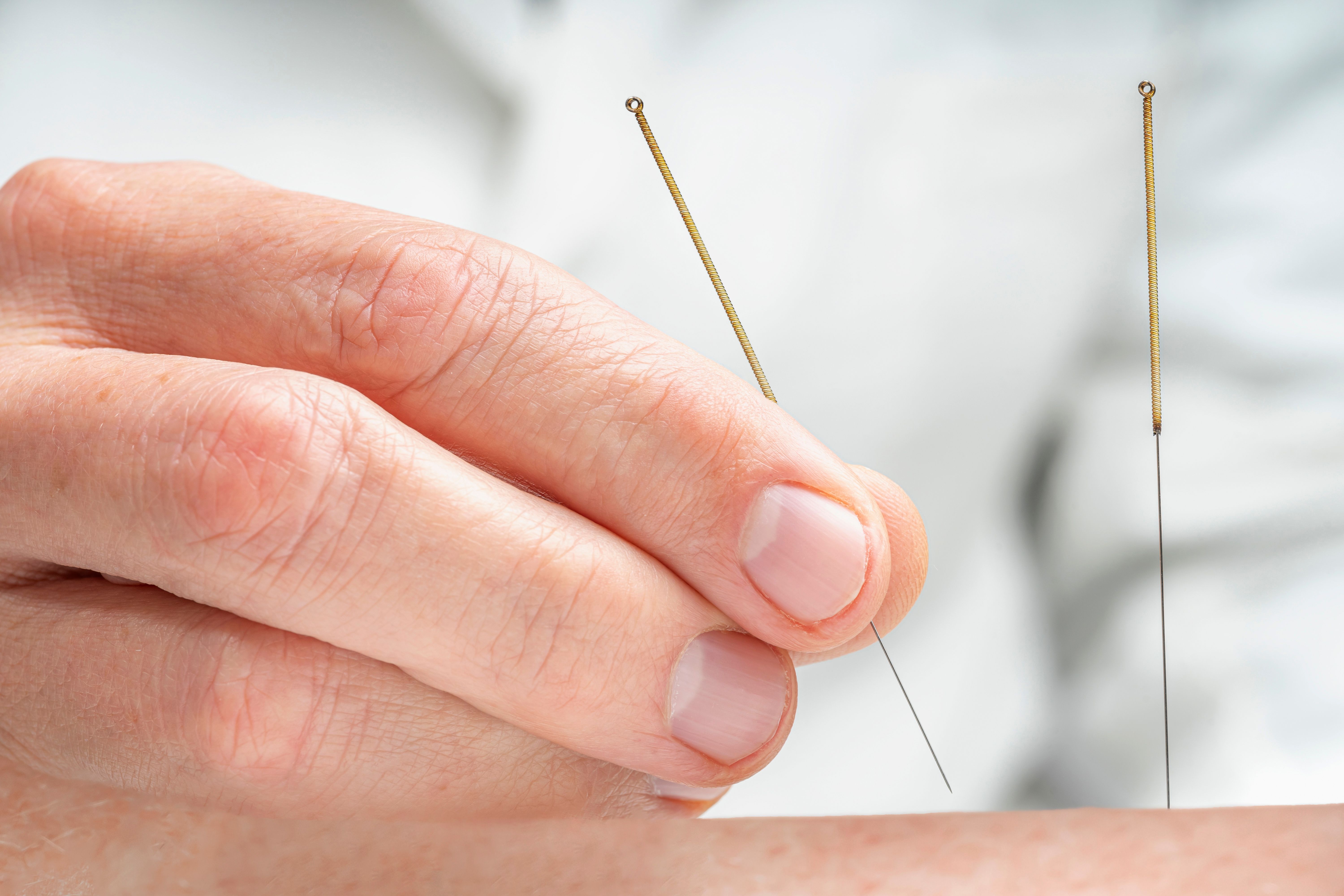 acupuncture practitioner