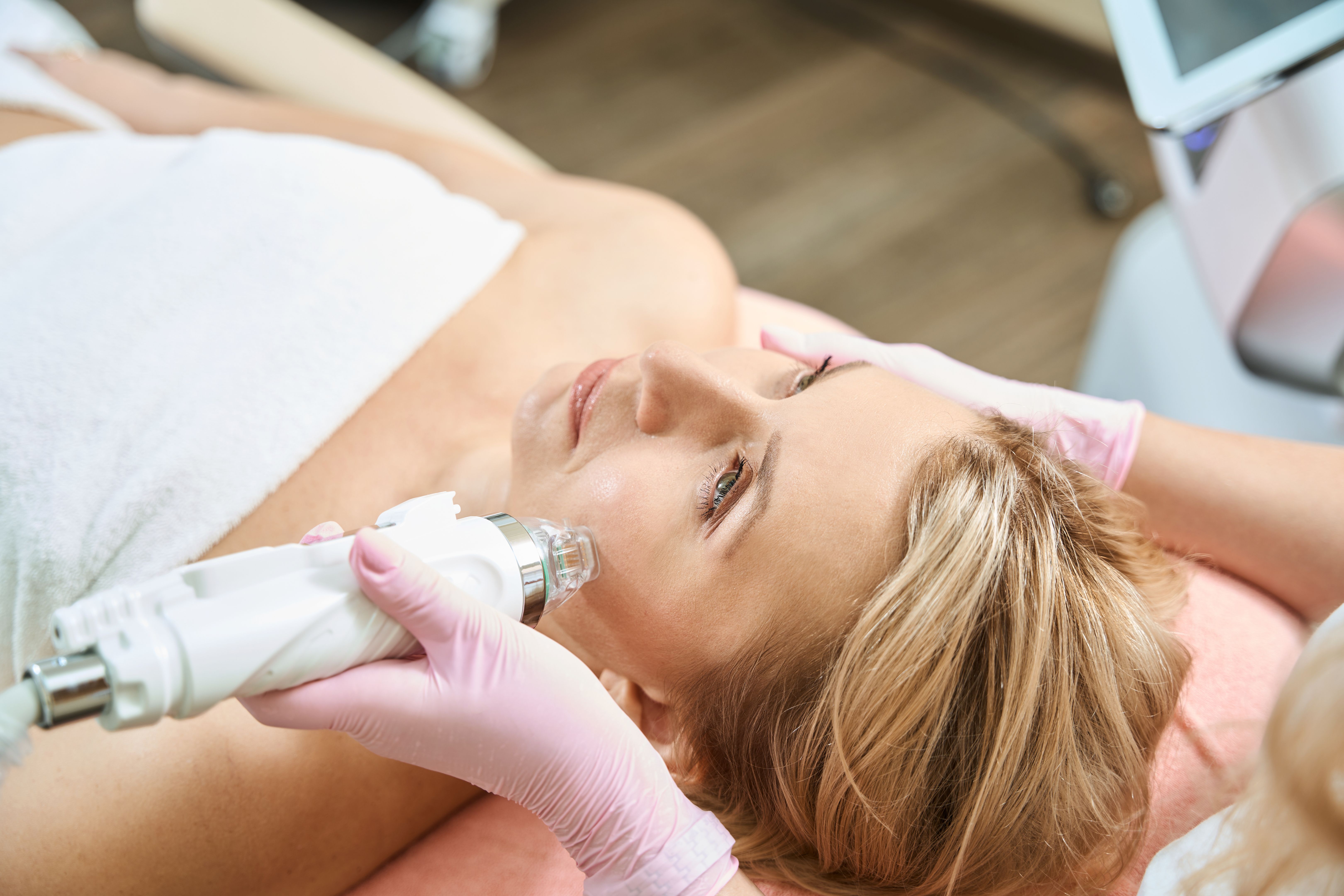 microneedling treatment
