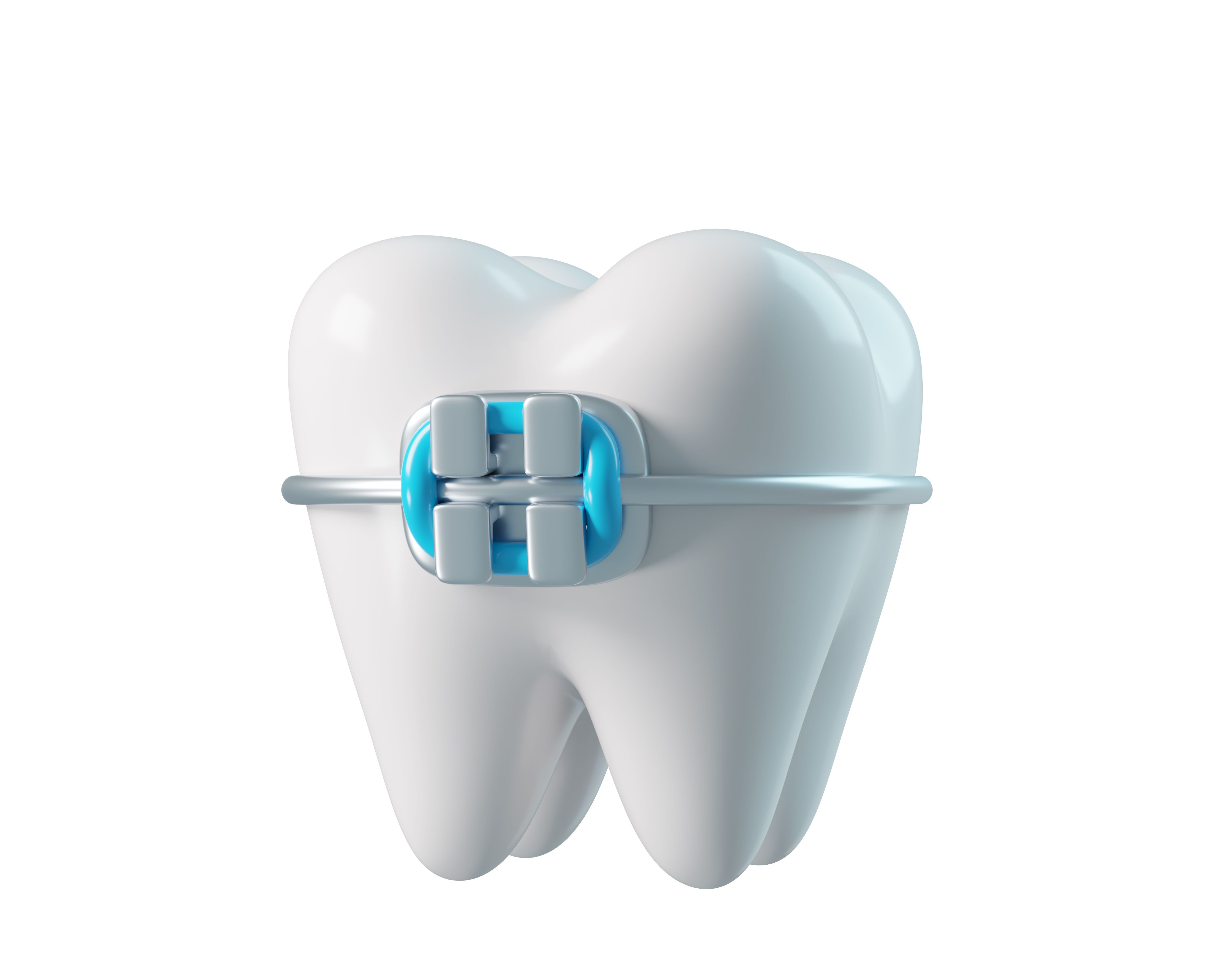 3D dental technology
