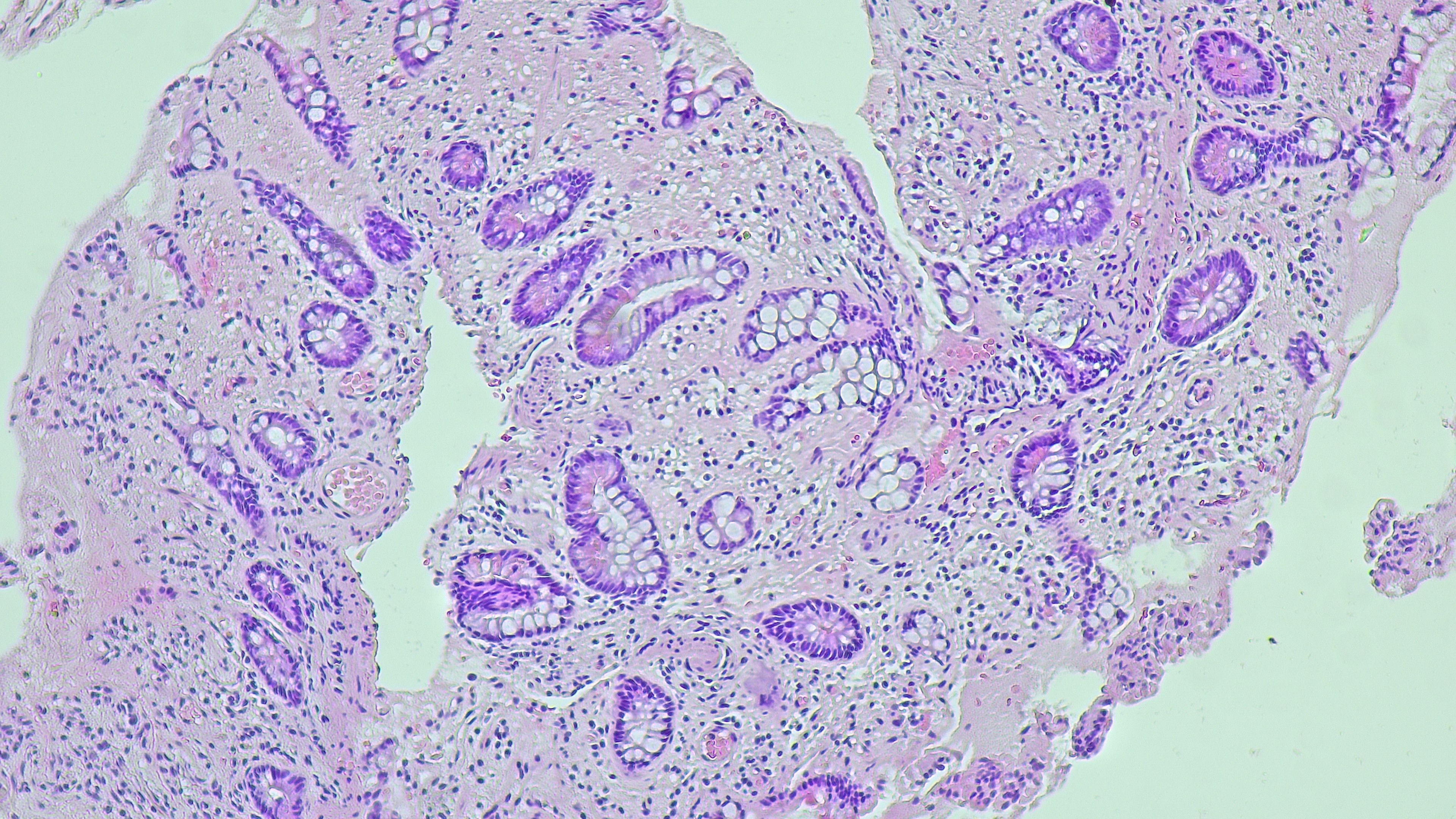 non surgical treatment