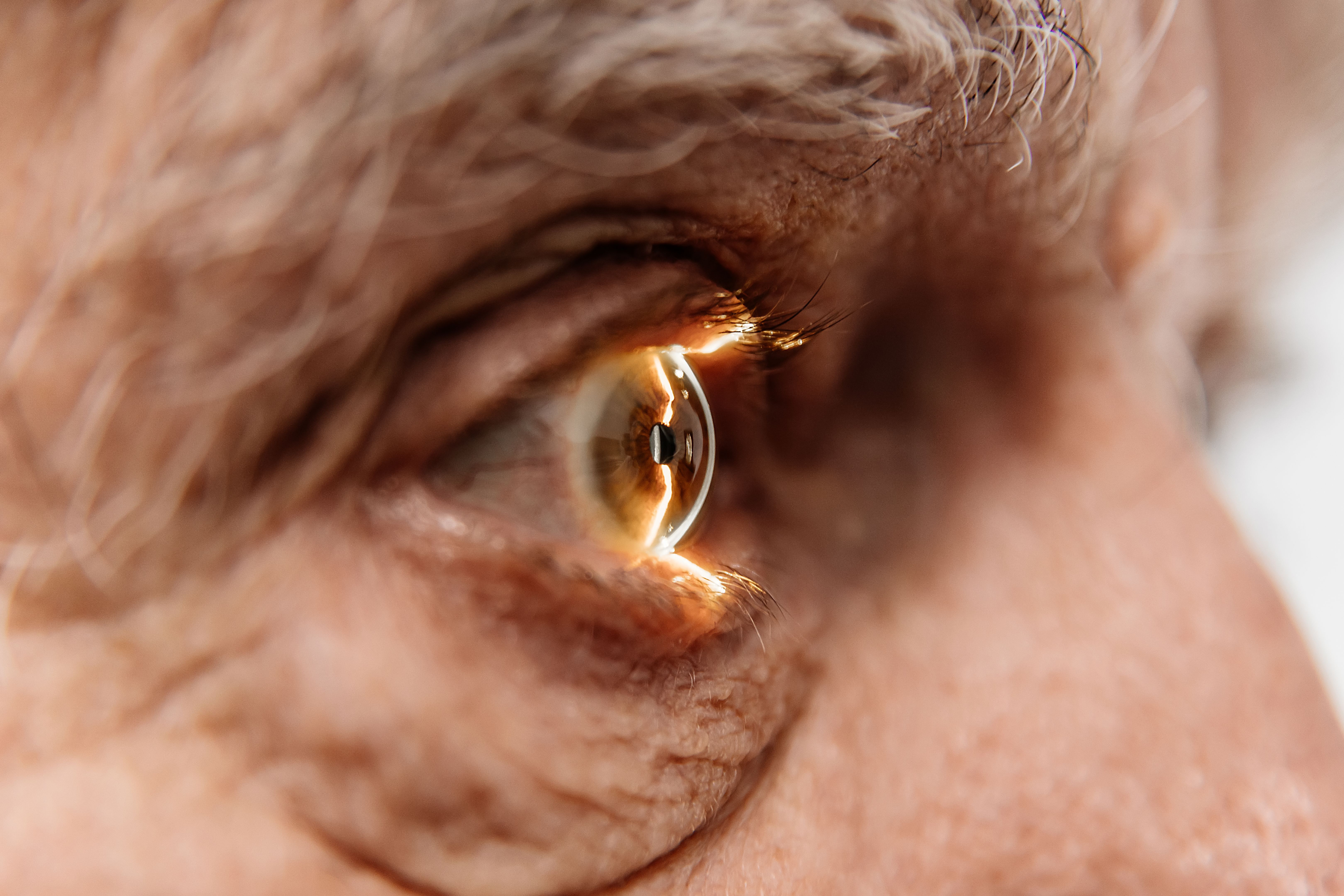 eye care