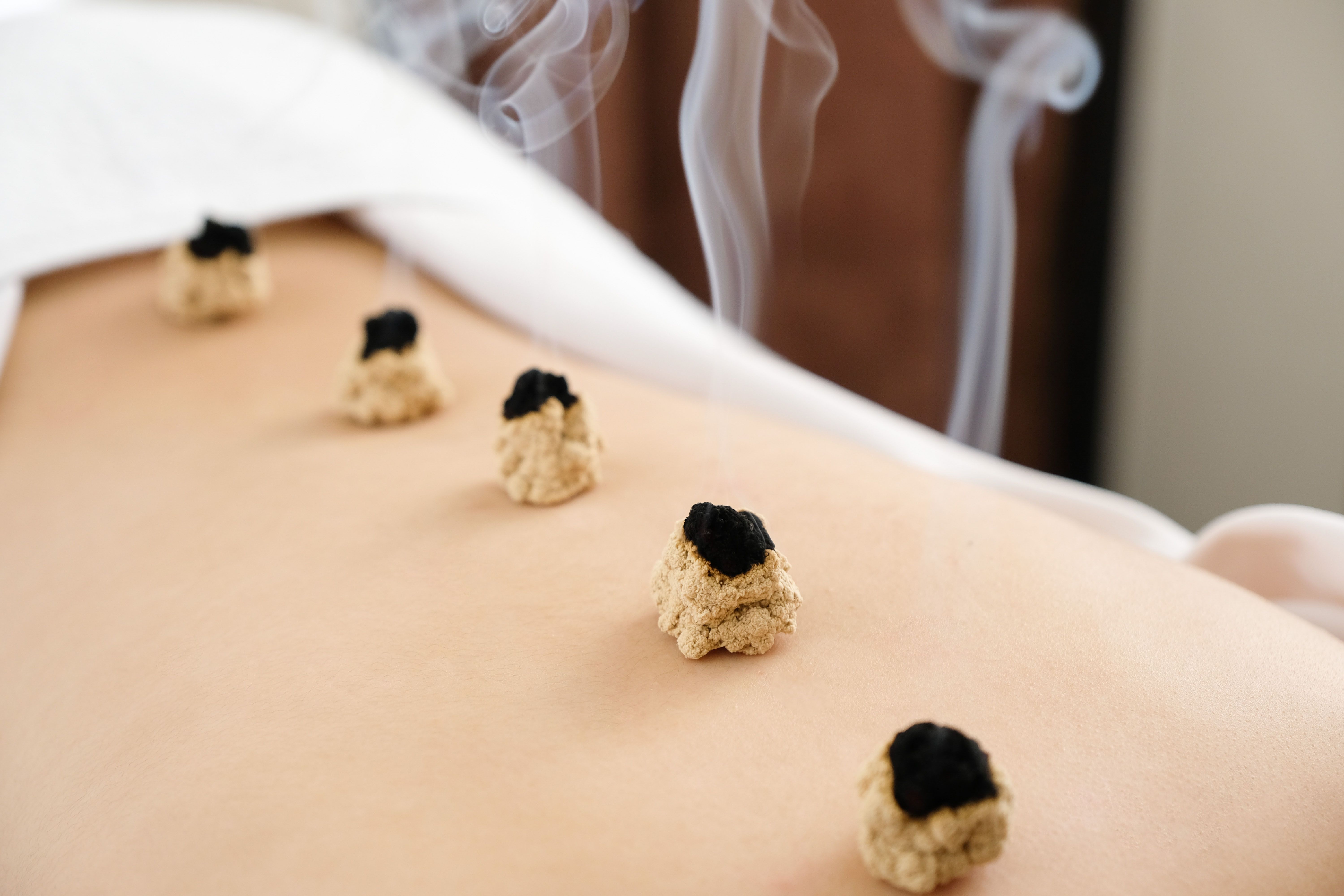 moxibustion treatment