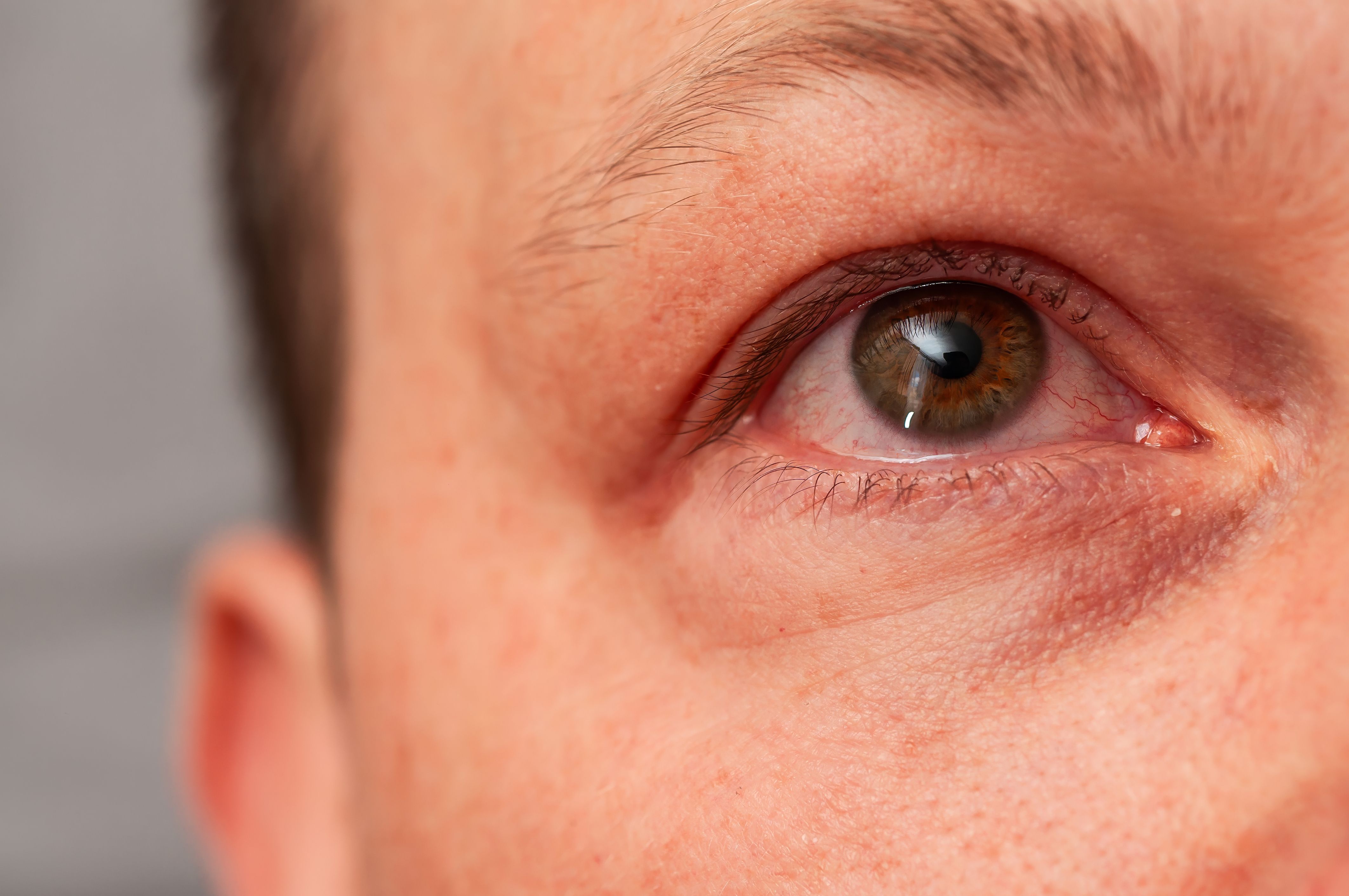 eyebrow consultation