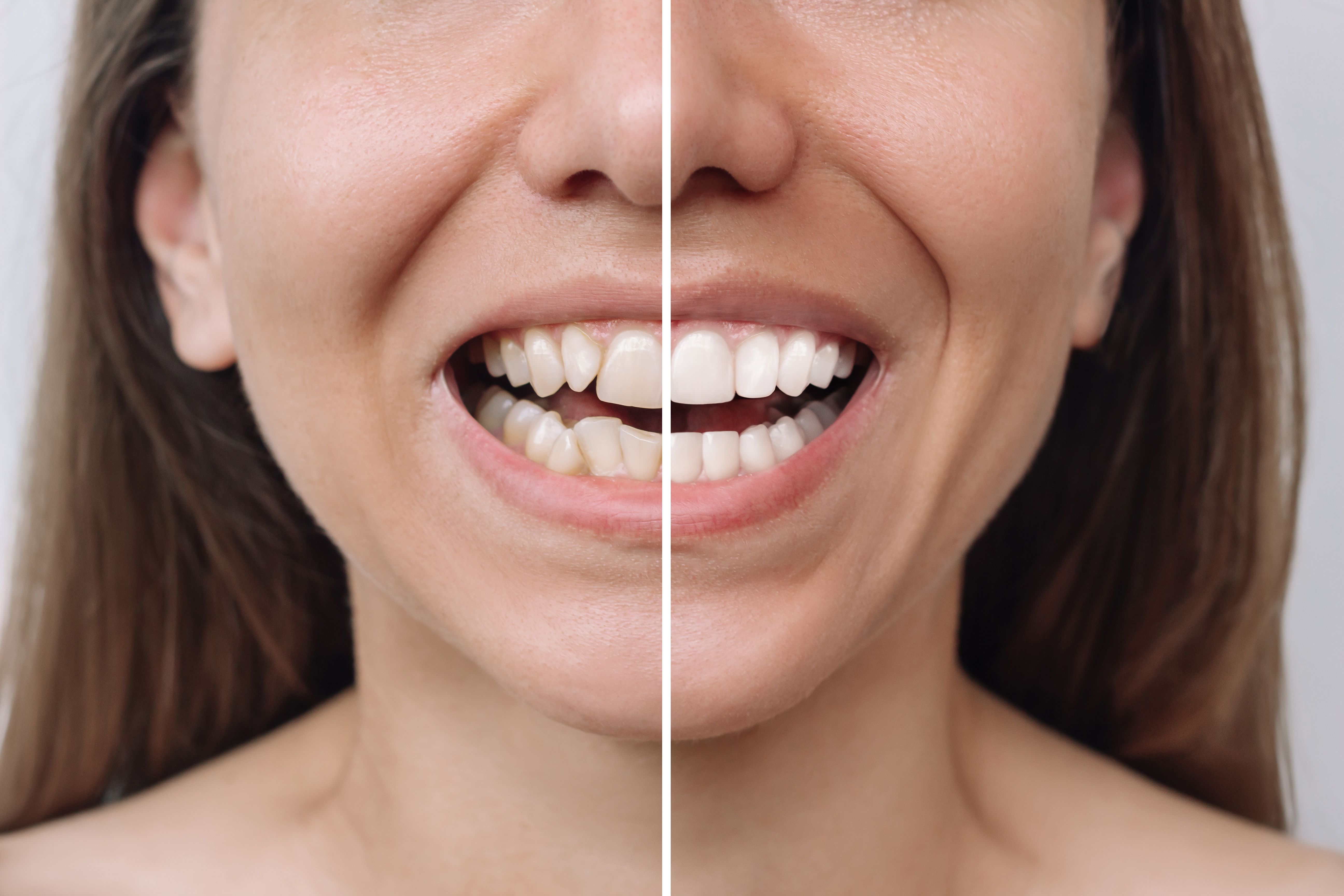 orthodontic comparison