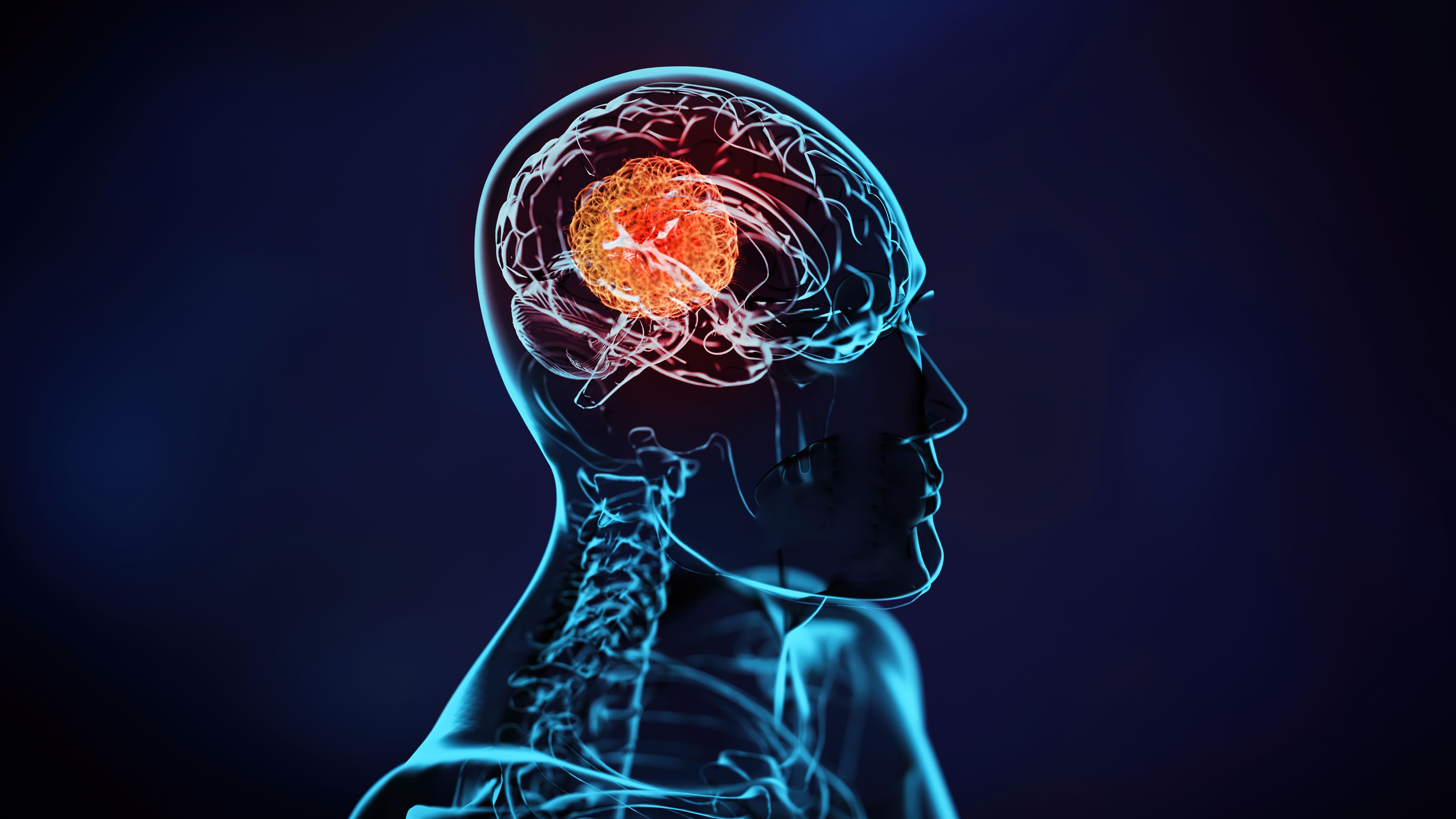 3D illustration of X-ray Imaging of a Human Brain with a Brain Tumor