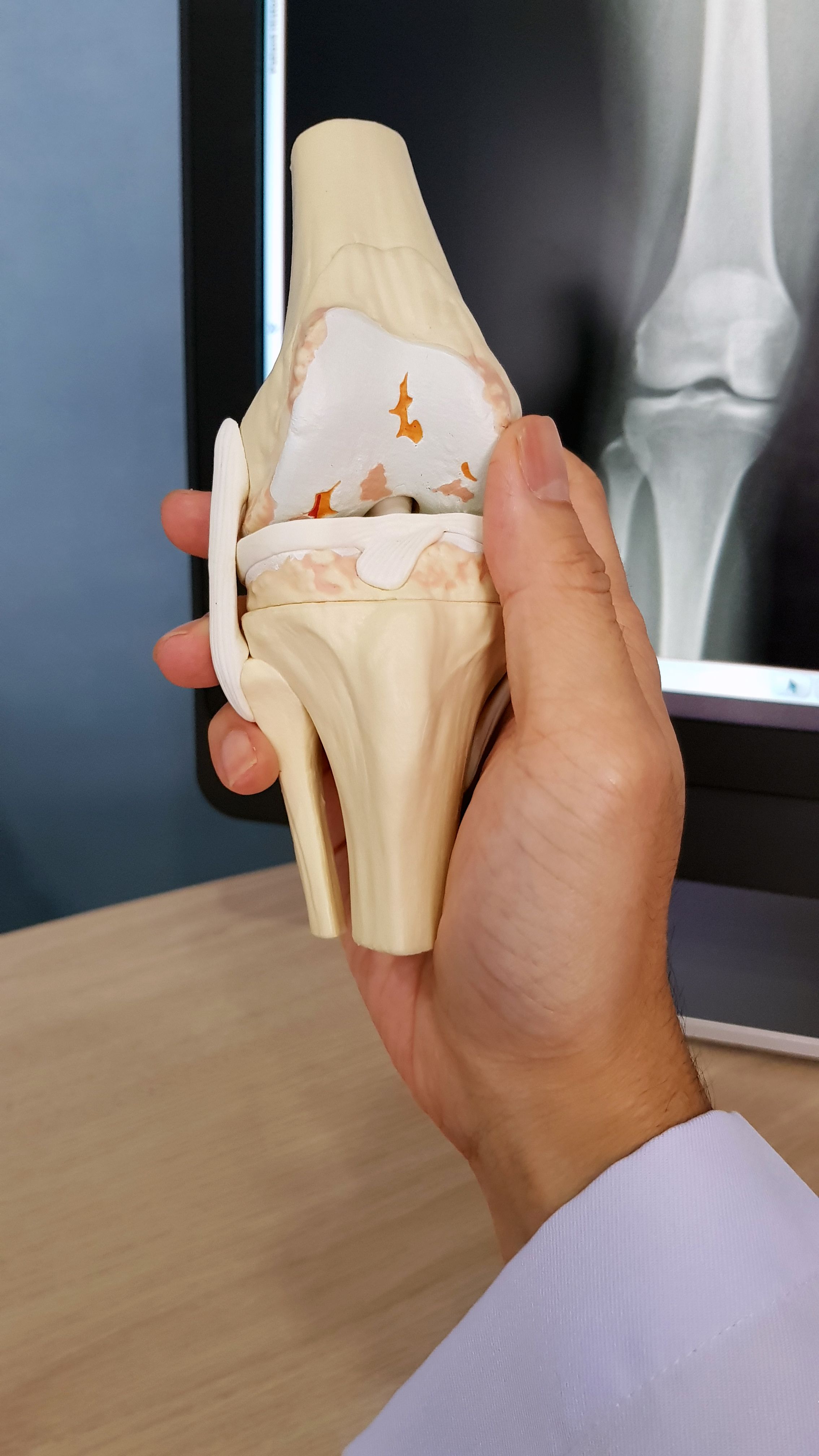 fisioterapia articular