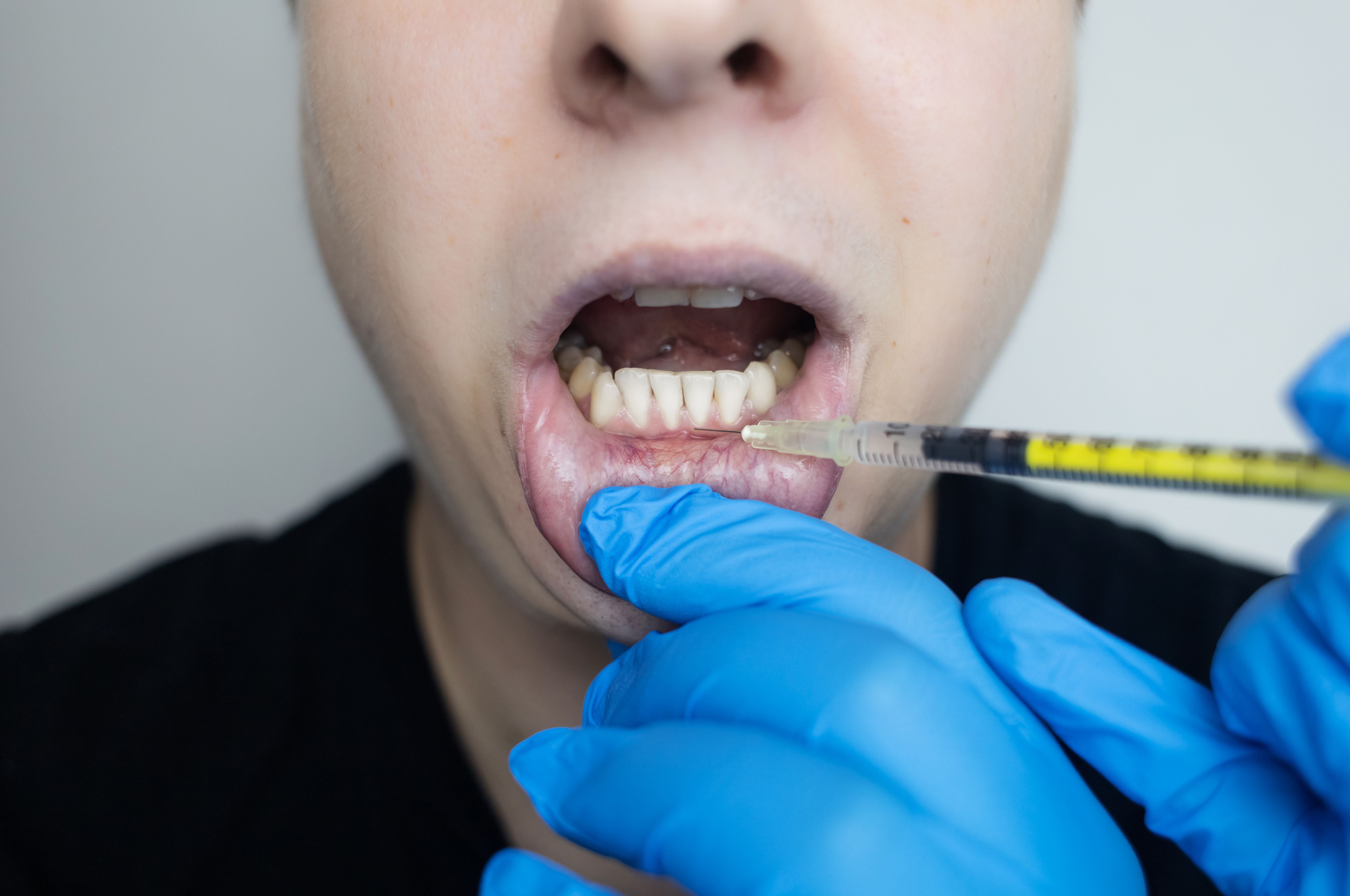 regenerative dental treatment