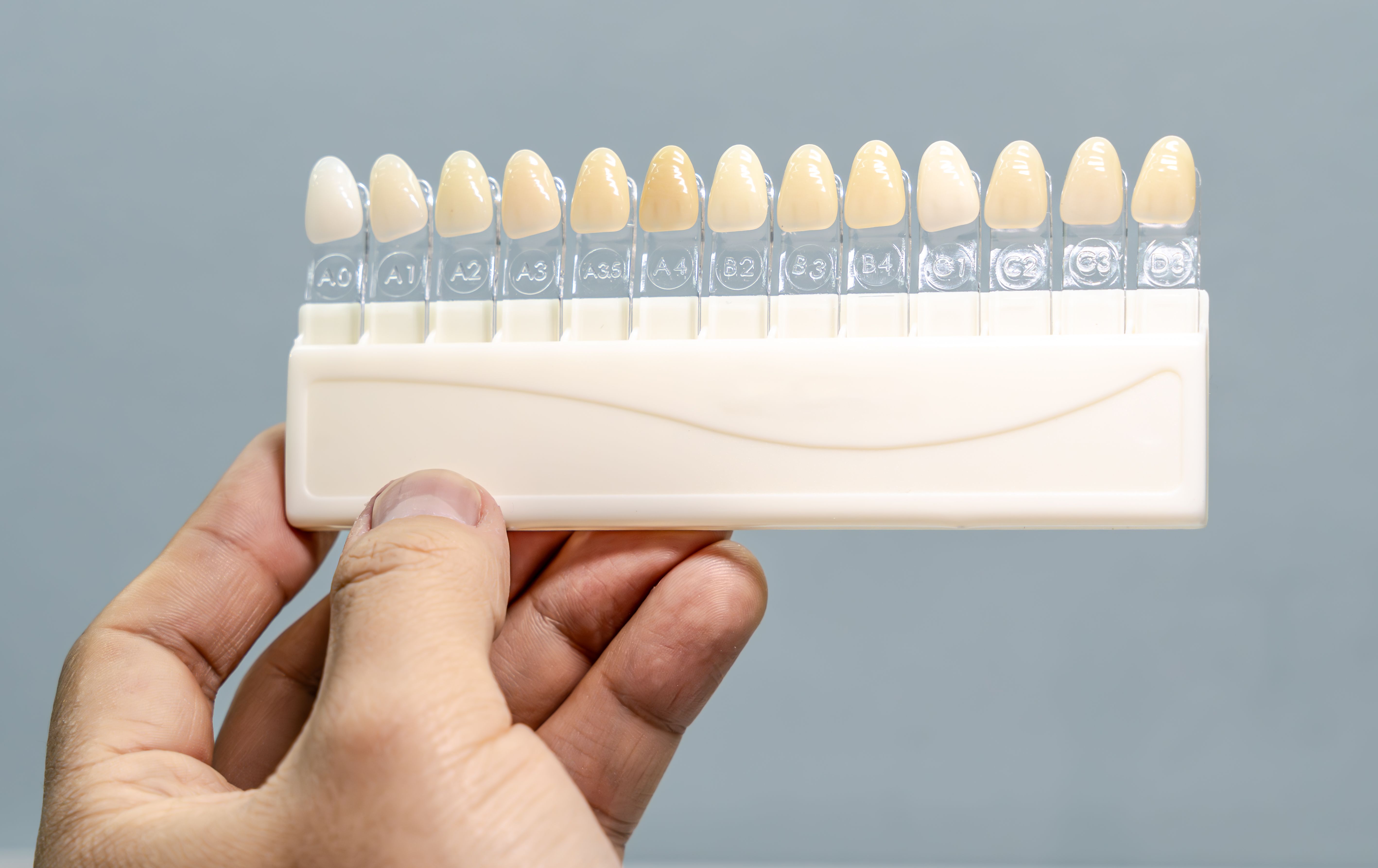 teeth whitening options