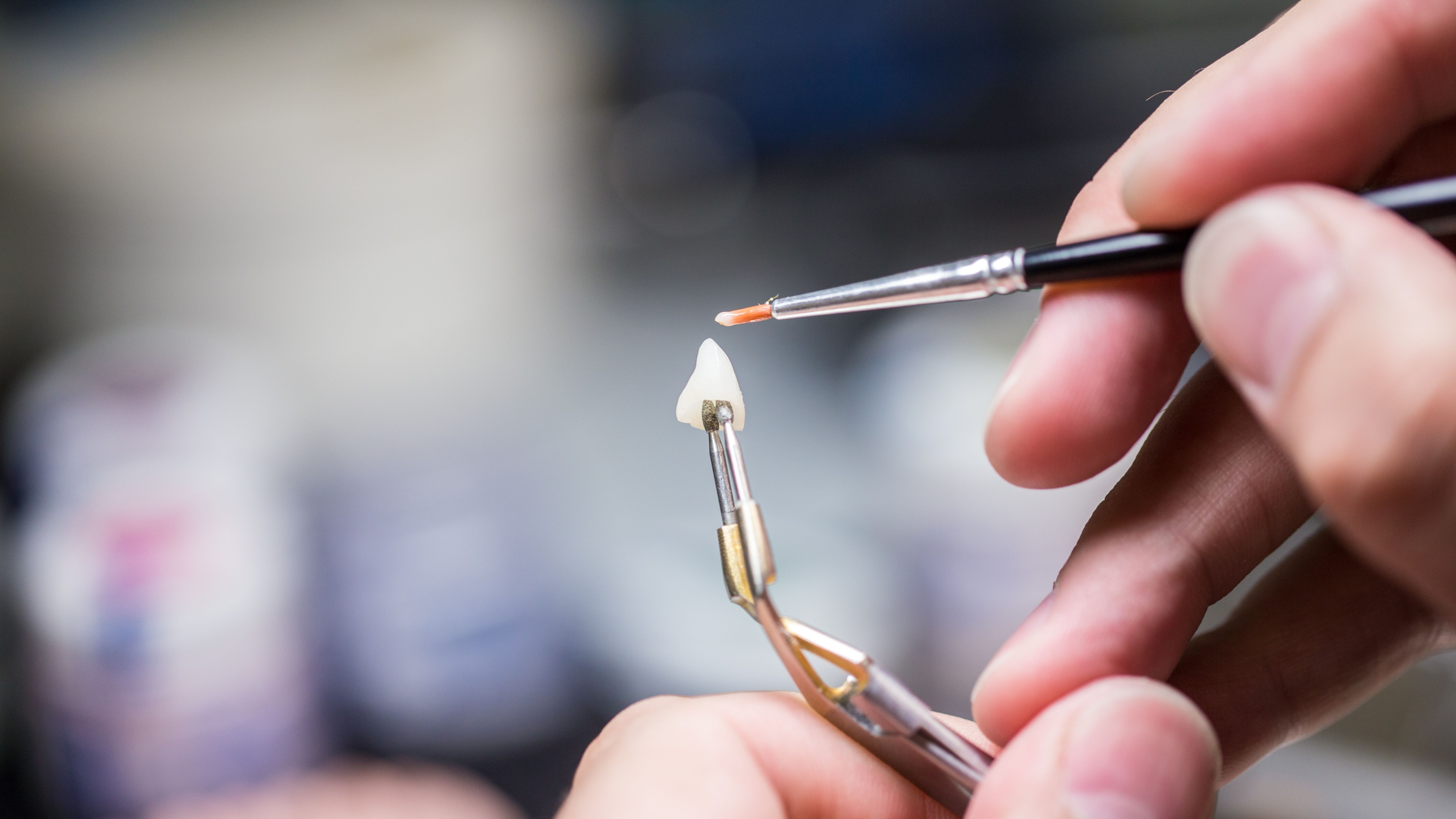 custom dental prosthetics