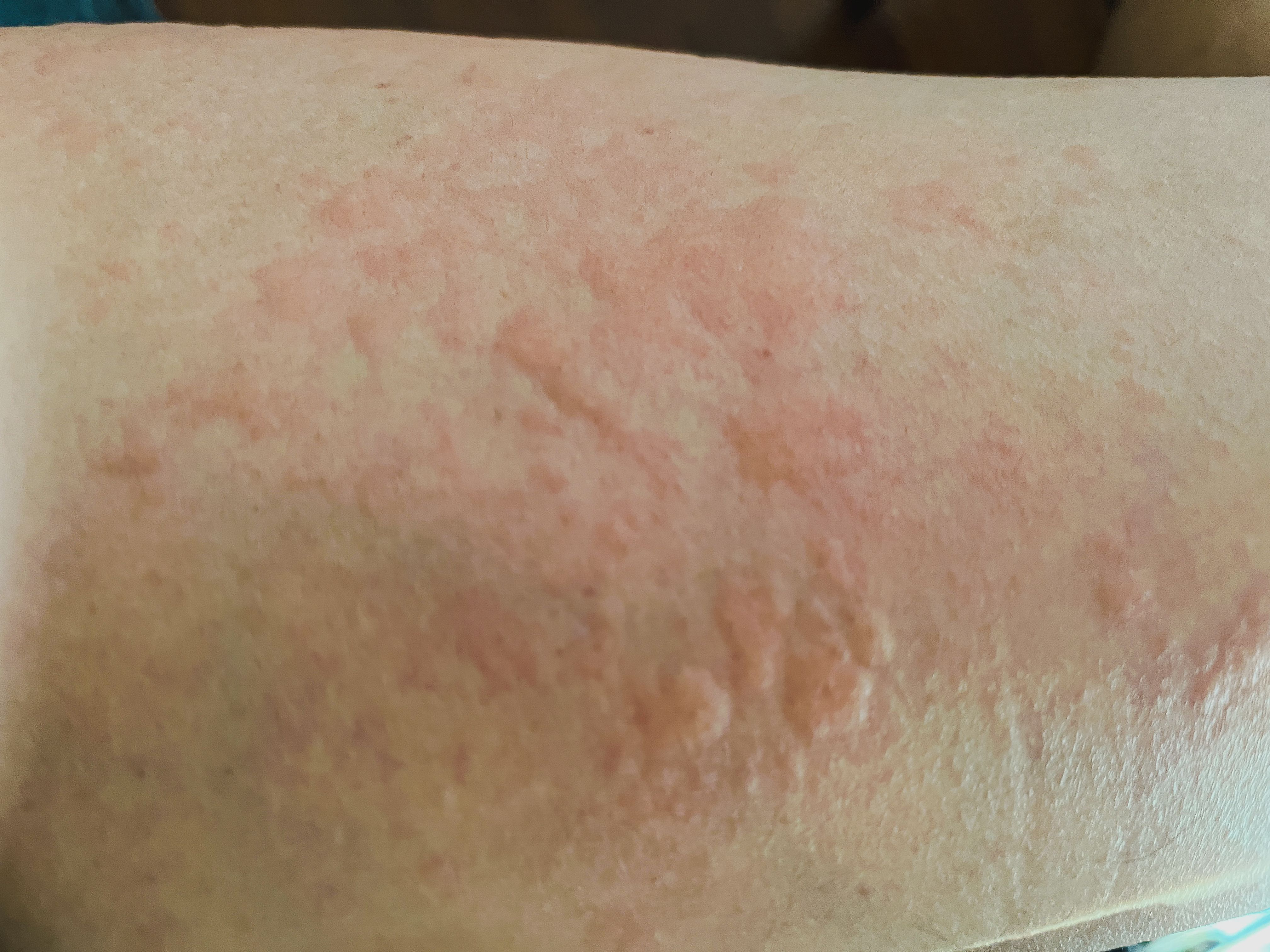 dermatologist analyzing