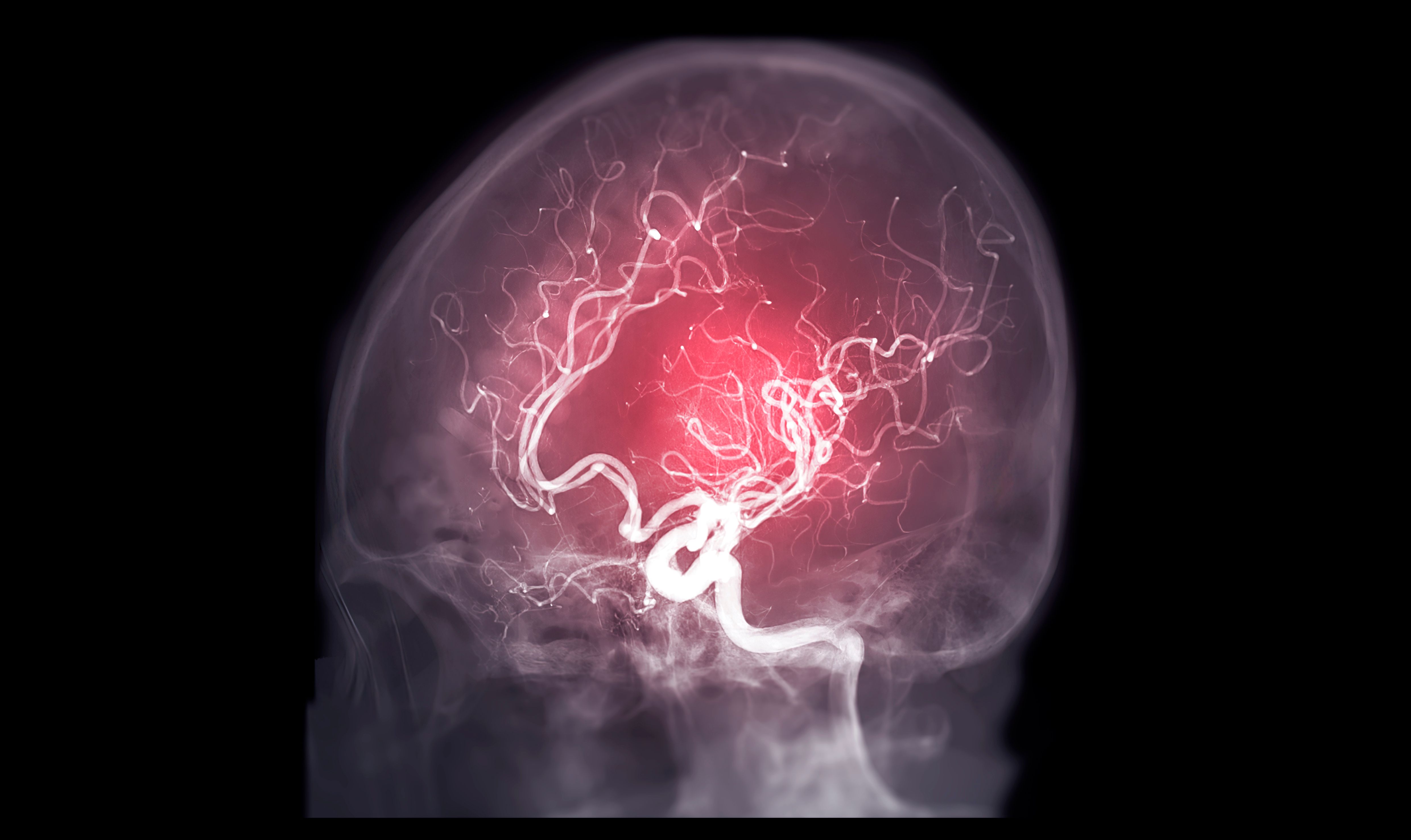 interventional radiology
