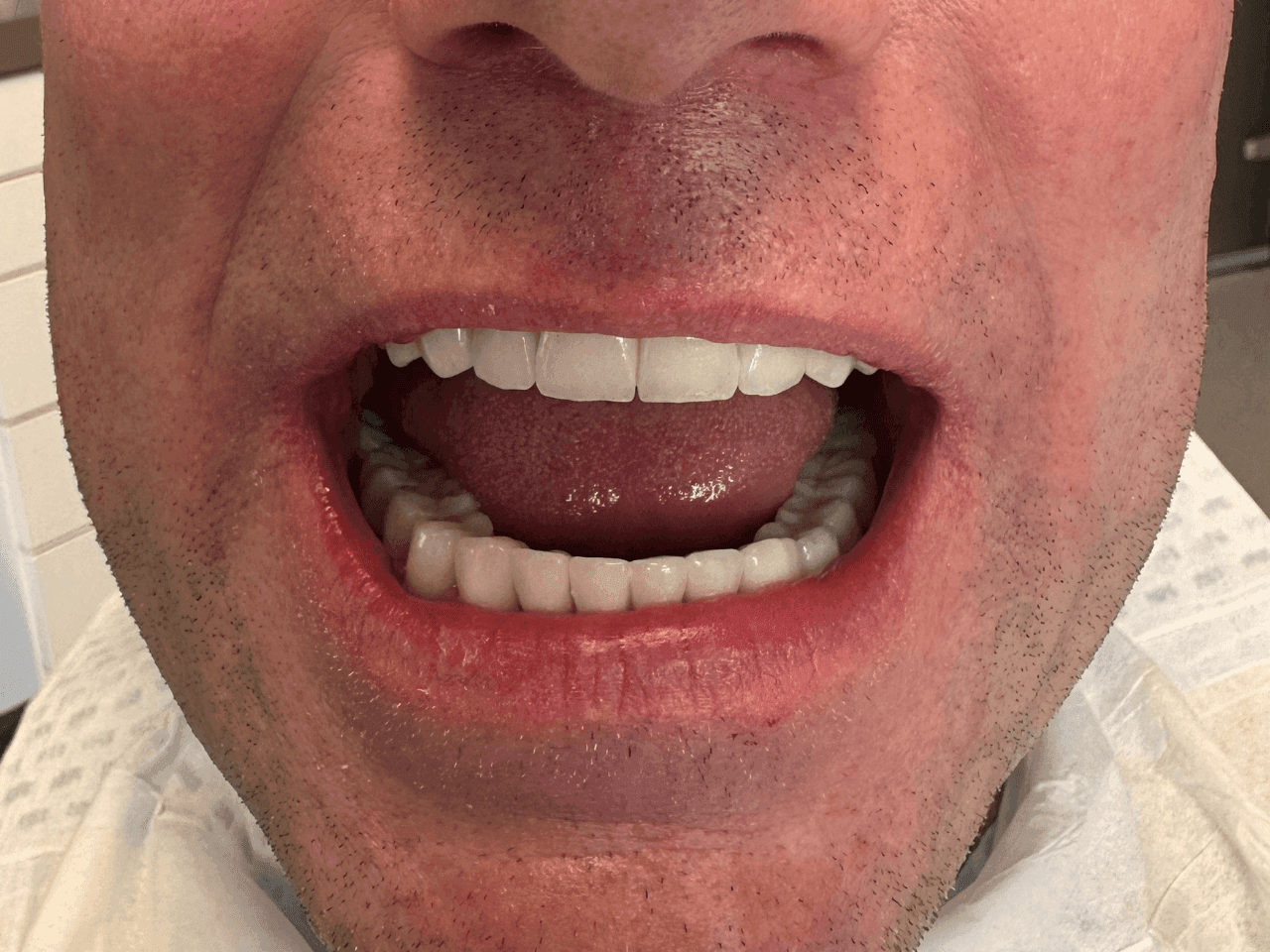 After dental treatment
